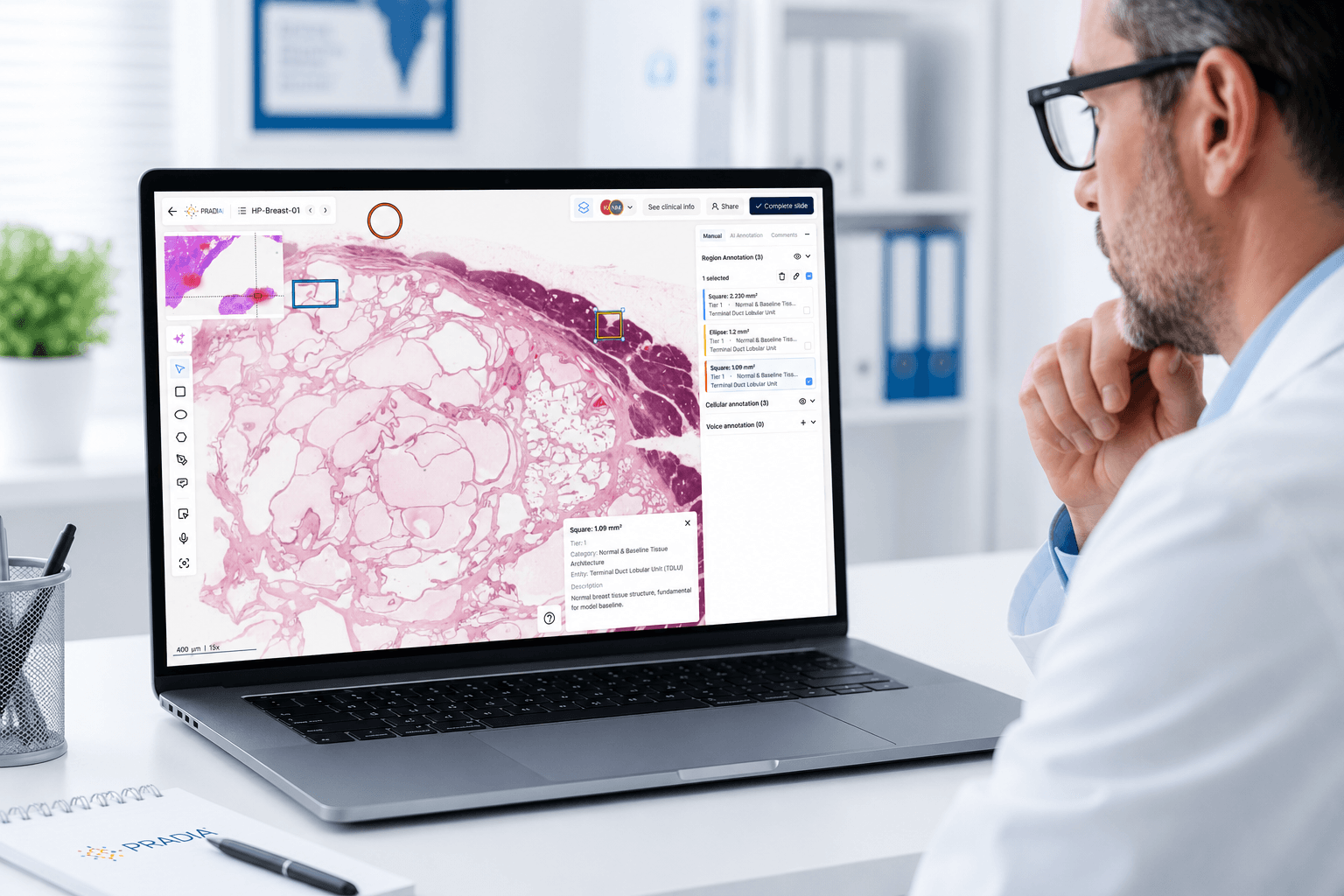 PRAID AI diagnostic platform running on a laptop